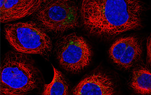 《PNAS》認(rèn)識溶酶體的知識又增加了