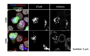 一種開創(chuàng)性的基因編輯技術(shù)可以修復免疫系統(tǒng)關(guān)鍵細胞缺陷