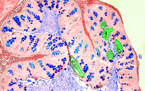 Nature新研究解答爭議，為炎癥性疾病的免疫機(jī)制提供新見解