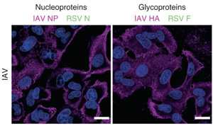 首次發(fā)現(xiàn)人肺細(xì)胞中形成的“雜交”病毒！更易感且可逃避免疫系統(tǒng)