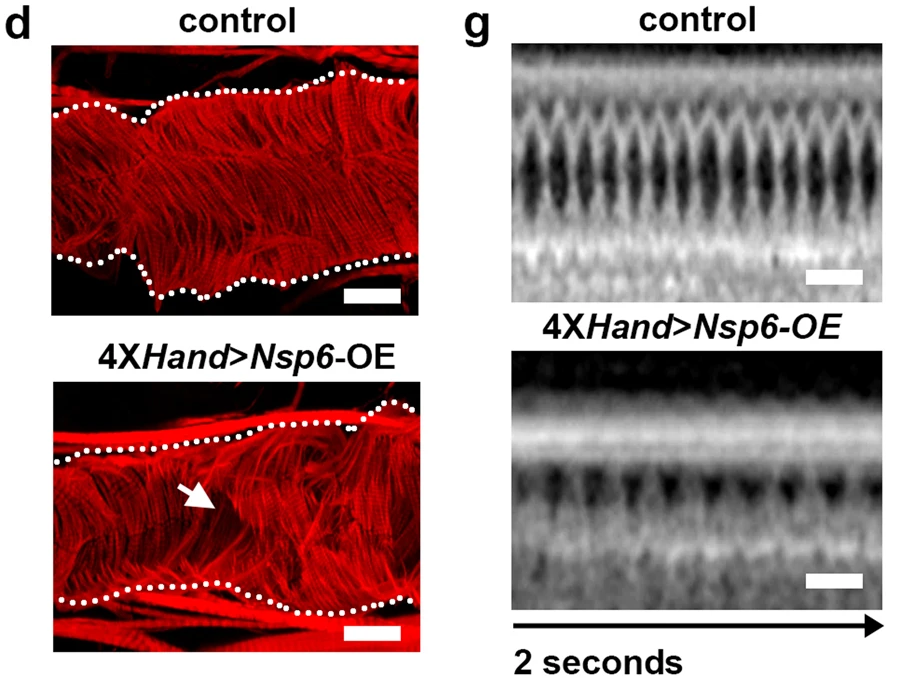 UAS-SARS-CoV-2Nsp6轉基因的4XH和Gal4、成纖維細胞特異性過表達（OE）誘導的成人心臟表型