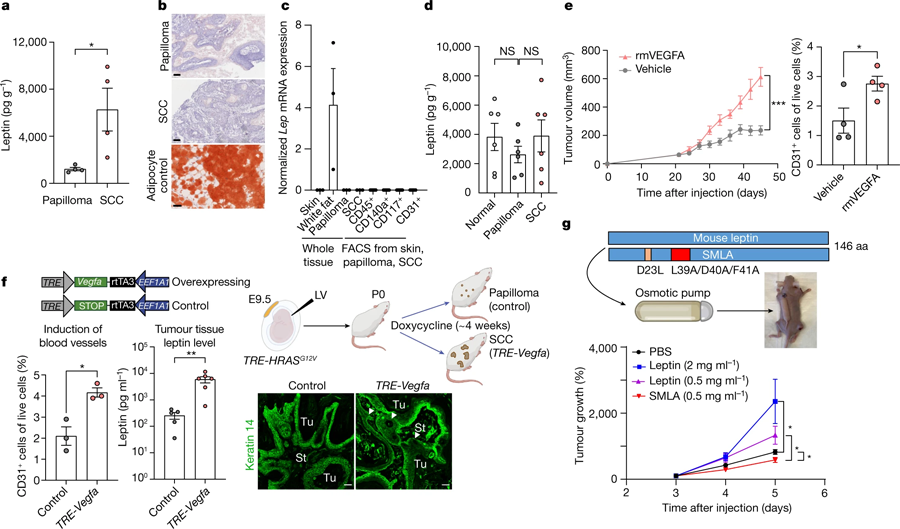 惡性腫瘤微環(huán)境中瘦素水平升高，是由血管生成增加引起的