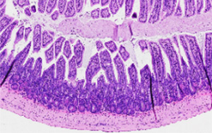 一種化合物可以逆轉(zhuǎn)小鼠的腸道炎癥