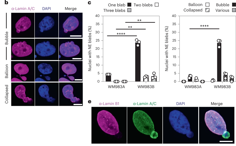 轉(zhuǎn)移性黑色素瘤細胞的NE(核包膜蛋白)是高度活躍的 轉(zhuǎn)移性黑色素瘤細胞的NE(核包膜蛋白)是高度活躍的
