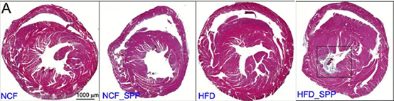 接種Spp病毒的高脂飲食小鼠心肌出現(xiàn)明顯的纖維化 接種Spp病毒的高脂飲食小鼠心肌出現(xiàn)明顯的纖維化