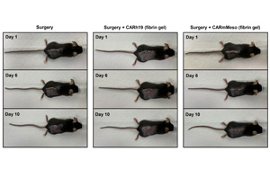 CAR-T細(xì)胞療法再獲突破！有效清除術(shù)后殘留癌細(xì)胞、預(yù)防腫瘤復(fù)發(fā)，即將開展臨床試驗