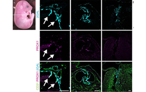 《Nature》淋巴系統(tǒng)潛在的新功能——造血！