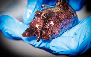 神經(jīng)信號調(diào)節(jié)新發(fā)現(xiàn)：L-或D-氨基酸？鏡像分子可改變神經(jīng)元的信號！