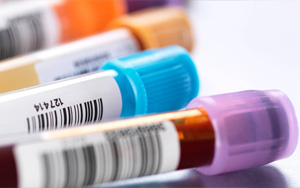 前白蛋白（PAB）檢測(cè)試劑盒原輔料