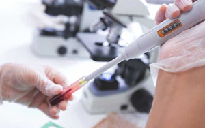 肌紅蛋白（MYO）檢測(cè)試劑盒用原輔料