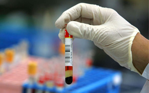 亮氨酰氨基肽酶（LAP）檢測(cè)試劑盒用原輔料