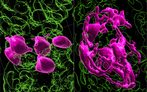 黑發(fā)原來是這樣變白的！Nature最新研究發(fā)現(xiàn)逆轉(zhuǎn)白發(fā)的關(guān)鍵所在