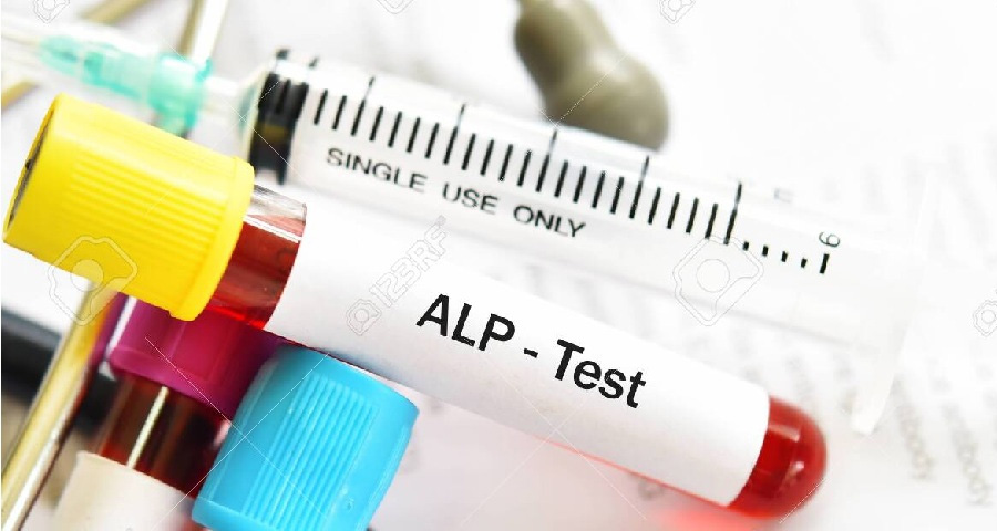 堿性磷酸酶檢測(cè) 堿性磷酸酶檢測(cè)