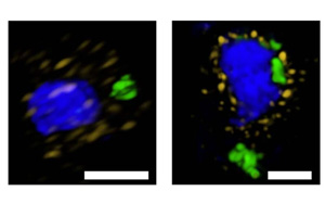 Nature子刊改變游戲規(guī)則：一種以前未知的細(xì)胞途徑