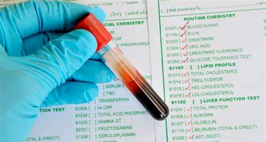 單胺氧化酶(MAO)檢測(cè) 單胺氧化酶(MAO)檢測(cè)