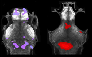 自閉癥相關(guān)基因集中在小膠質(zhì)細胞和多巴胺上
