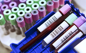 乳酸脫氫酶（LD/LDH）檢測(cè)試劑盒用原輔料