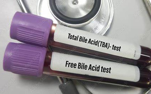 總膽汁酸（TBA）檢測(cè)試劑盒用原輔料