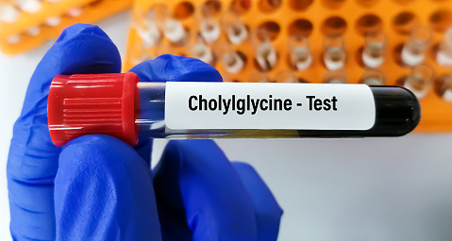 總膽汁酸(TBA)檢測(cè) 總膽汁酸(TBA)檢測(cè)