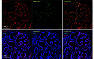 一種罕見基因突變，感覺不到疼痛！新研究揭示其獨(dú)特的分子機(jī)制