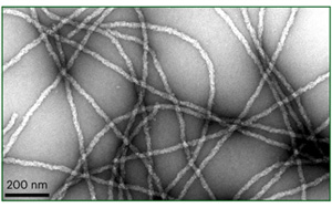 一個(gè)高度不穩(wěn)定的蛋白質(zhì)導(dǎo)致神經(jīng)退化