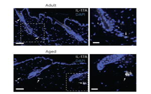 IL-17蛋白對(duì)皮膚老化的關(guān)鍵作用