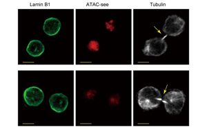 是什么決定了CD8+ T細(xì)胞的命運(yùn)？Immunity新研究指向cBAF復(fù)合物