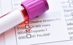 心肌肌鈣蛋白T（cTnT）-磁微粒化學發(fā)光法（吖啶酯） /熒光免疫層析解決方案