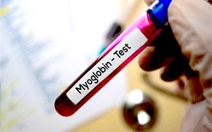 肌紅蛋白（Myo）-磁微?；瘜W發(fā)光（AE/AP） /熒光免疫層析解決方案