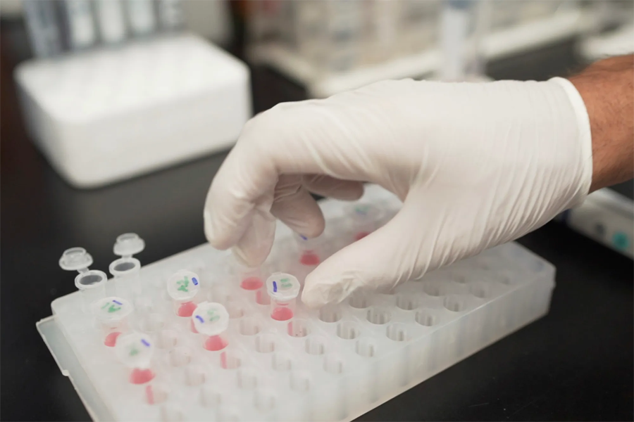 阿爾茲海默癥早期診斷標志物 阿爾茲海默癥早期診斷標志物