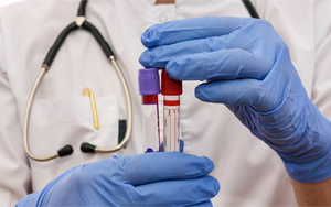 肌酸激酶同工酶（CK-MB）-磁微?；瘜W(xué)法學(xué)發(fā)光（AE/AP） /熒光免疫層析解決方案