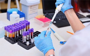 可溶性生長(zhǎng)刺激表達(dá)基因2蛋白（ST2）- 磁微?；瘜W(xué)發(fā)光法（吖啶酯）/熒光免疫層析解決方案