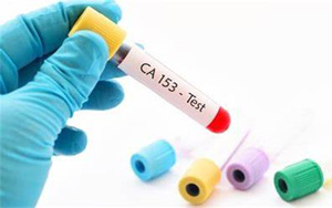 糖類抗原15-3(CA15-3)-磁微?；瘜W(xué)發(fā)光法（AE/AP）解決方案