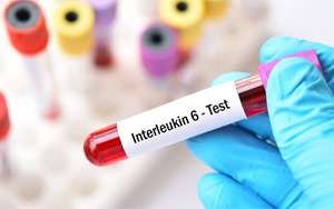 白介素-6（IL-6）-磁微?；瘜W(xué)發(fā)光（吖啶酯） /熒光免疫層析解決方案