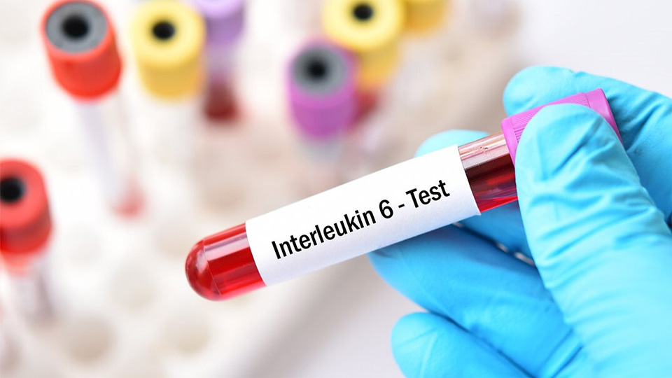 IL-6磁微?；瘜W(xué)發(fā)光熒光免疫層析