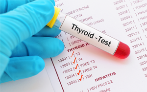 促甲狀腺素（TSH）-磁微?；瘜W(xué)發(fā)光法（吖啶酯） /熒光免疫層析解決方案