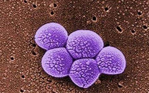 《Science》突破性新抗生素，遏制耐藥細(xì)菌