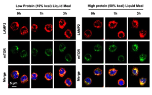 Nature子刊亮氨酸暴露實(shí)驗(yàn)證明高蛋白飲食如何使你的動(dòng)脈硬化
