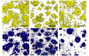 Nature：光和聲可以清除阿爾茨海默氏癥小鼠的淀粉樣蛋白！