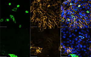 Nature最新研究表明，一類新的抗病毒藥物可以對(duì)抗SARS-CoV-2