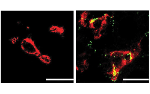 Nature子刊：肝臟中的免疫細(xì)胞會(huì)對(duì)高膽固醇水平做出反應(yīng)，并吃掉多余的膽固醇