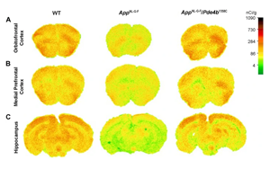發(fā)現(xiàn)阿爾茨海默病的新治療靶點(diǎn)PDE4B 活性降低27%可大大挽救AD小鼠記憶、大腦功能和炎癥