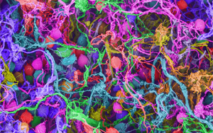 Nature：要想形成長期記憶，必須有DNA損傷和腦部炎癥？！