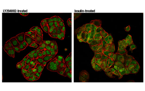 Nature最新發(fā)現(xiàn)控制CAR-T細胞壽命的蛋白質(zhì)！
