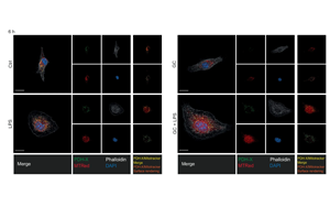 《Nature》第一次揭開糖皮質(zhì)激素如何激活人體對炎癥的自然“剎車”