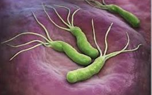 幽門螺桿菌(HP.CagA)-磁微粒化學(xué)發(fā)光法（AE/AP）解決方案